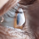 The Symptoms, Causes, and Remedies for Keratoconus